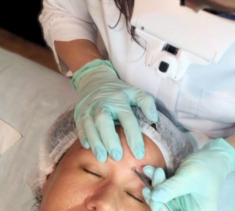 Estética Facial